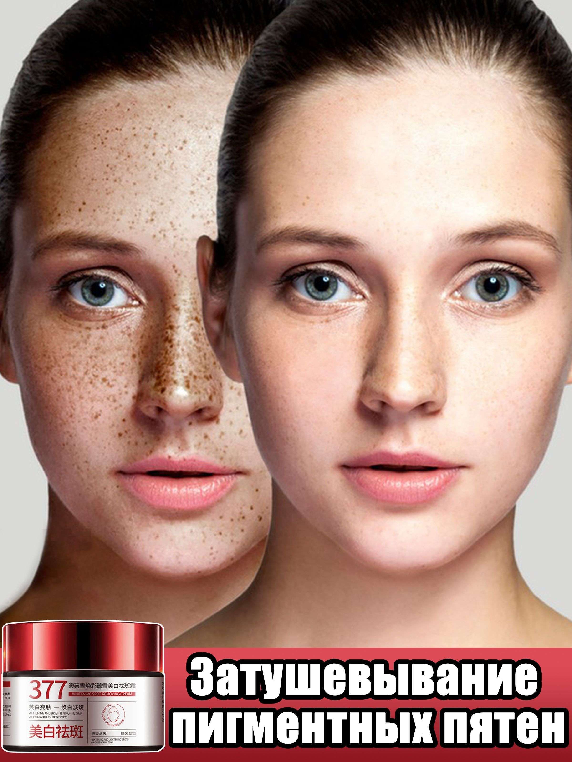 Народный способ осветления веснушек с помощью простокваши и заговора