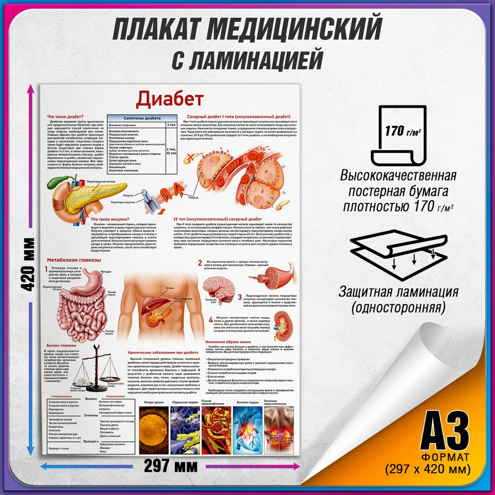 Информационный медицинский плакат "Диабет" / ламинированный / А-3 (30x42 см.)  #1