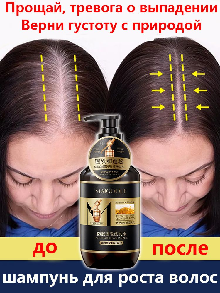 LYDIMOON Шампунь для волос, 400 мл #1