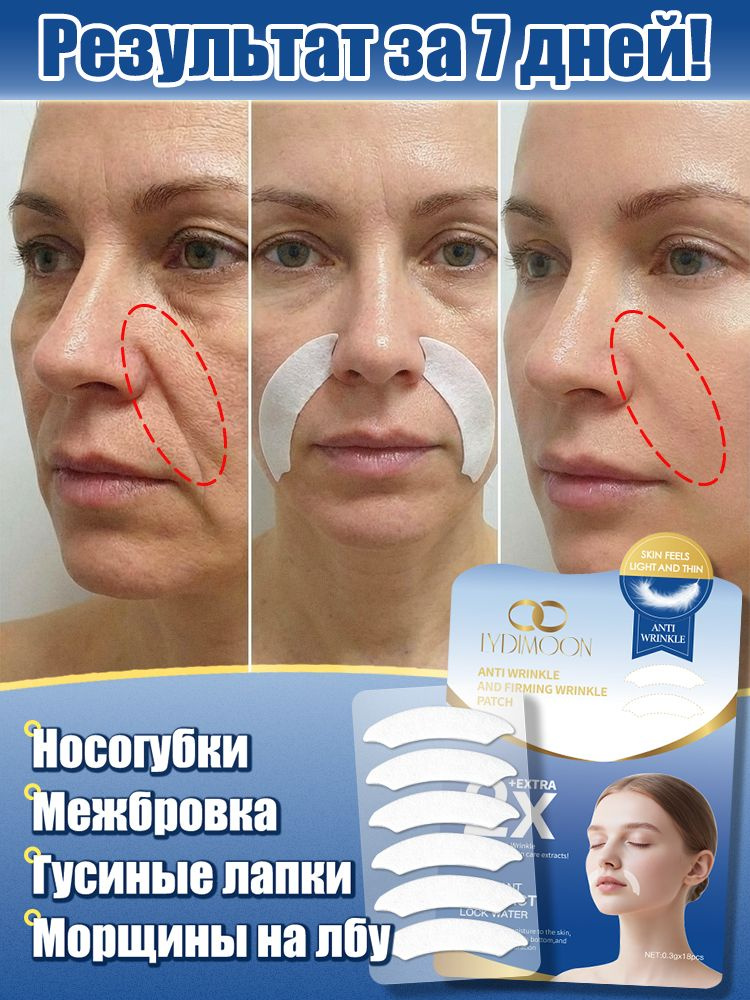 Патчи для лица от морщин и носогубных складок с пептидами, лифтинг-эффект, эффект за 7 дней, 18 шт #1