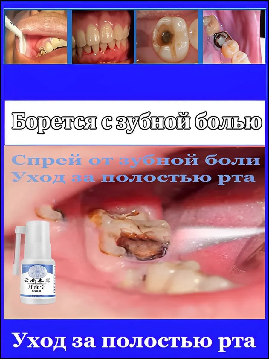 Спрейотзубнойболи,лечитзубнуюболь,быстроснимаетболь