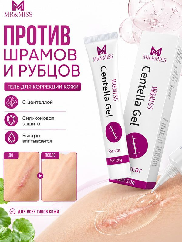 Kрем от шрамов и рубцов, от шрамов и рубцов, крем от растяжек, прыщей, постакне и ожогов 20 г #1