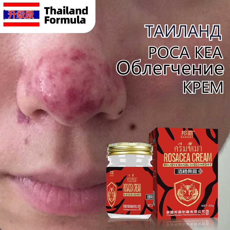 Крем от купероза и розацеа от покраснений и раздражений на коже,50 г ...
