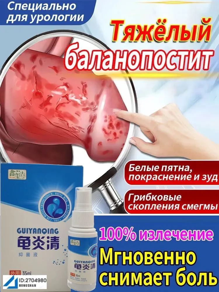 Спрейдлямужчинприбаланопостите,35мл,быстроеоблегчениезуда,жженияипокраснениявинтимнойзоне