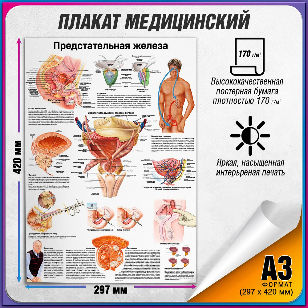 Информационный медицинский плакат "Предстательная железа" / А-3 (30x42 см.)  #1