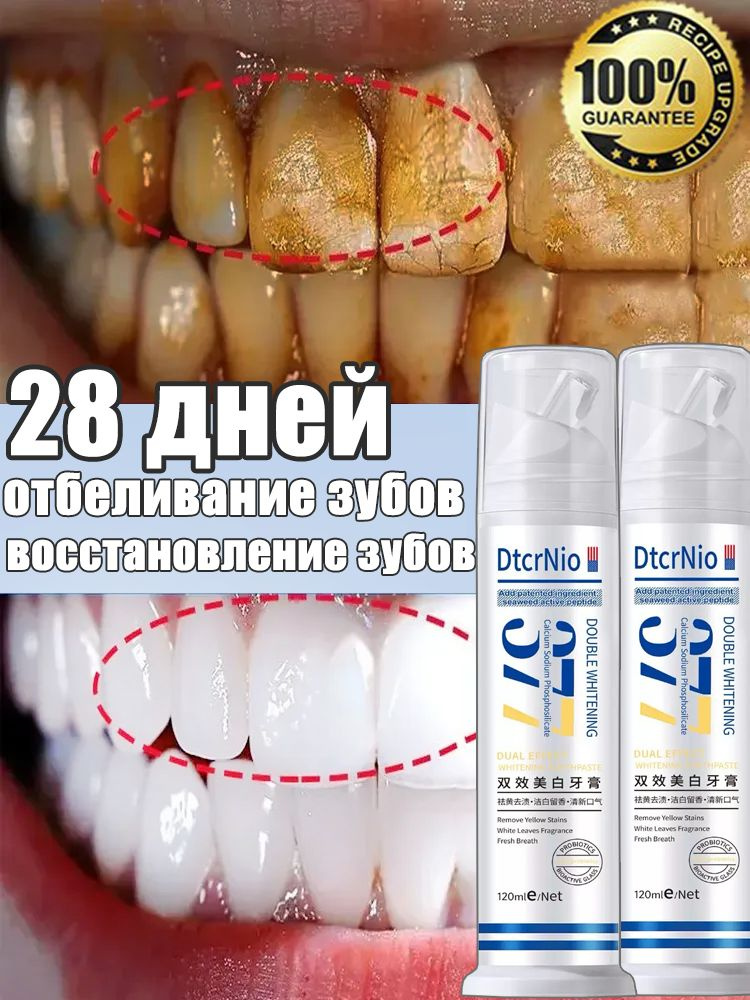 Мощная отбеливающая зубная паста, против зубного камня и налета от кофе и сигарет, против неприятного #1