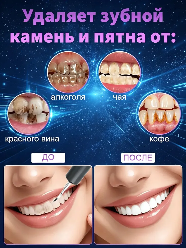 Скалер ультразвуковой для удаления зубного камня для бытового применения T8 чёрный, черный, фото 6