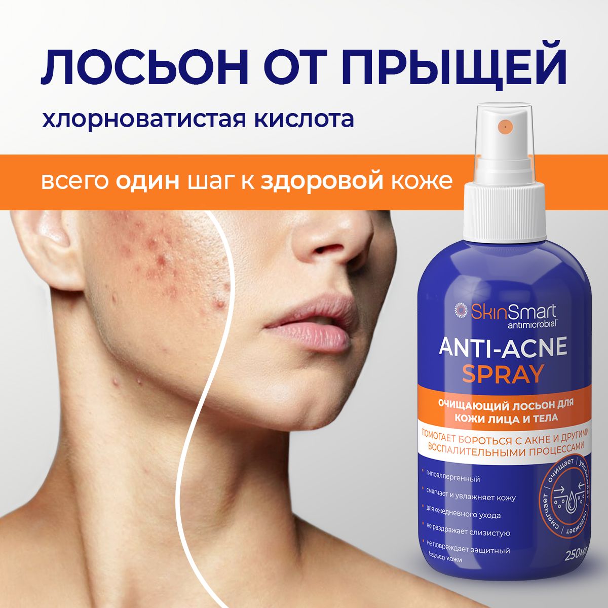 Тоник для лица, хлорноватистая кислота, лосьон от прыщей, SkinSmart