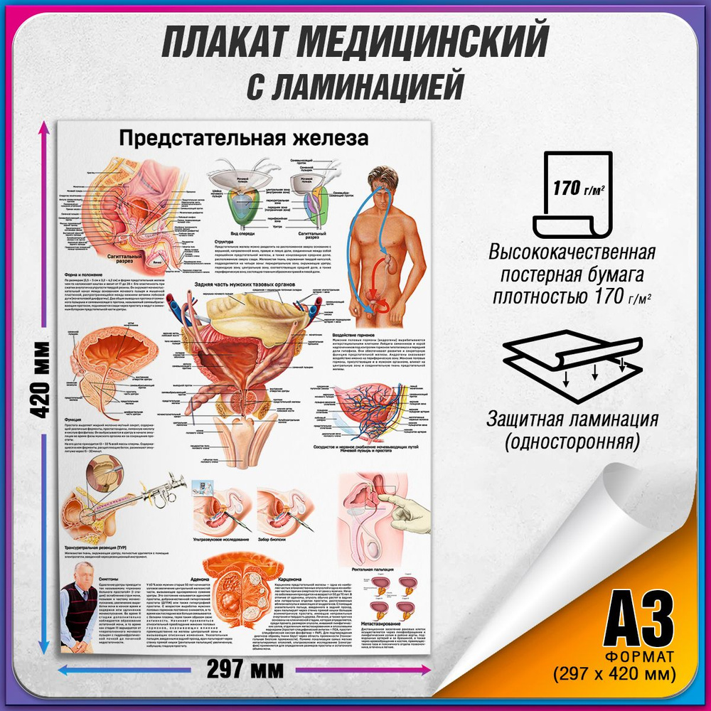 Информационный медицинский плакат "Предстательная железа" / ламинированный / А-3 (30x42 см.)  #1