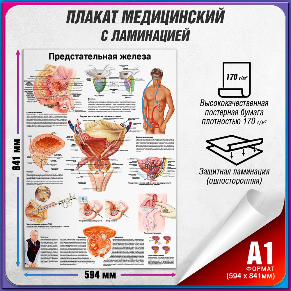 Информационный медицинский плакат "Предстательная железа" / ламинированный / А-1 (60x84 см.)  #1