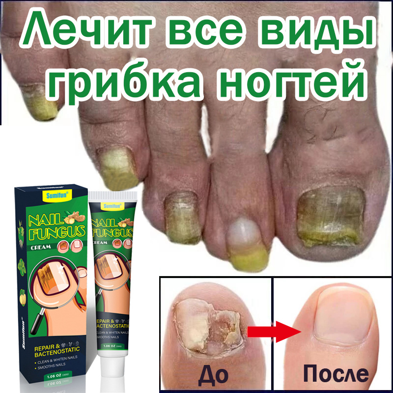Мазь от грибка ногтей на ногах 30 г,противогрибковое средство, Алтея ...
