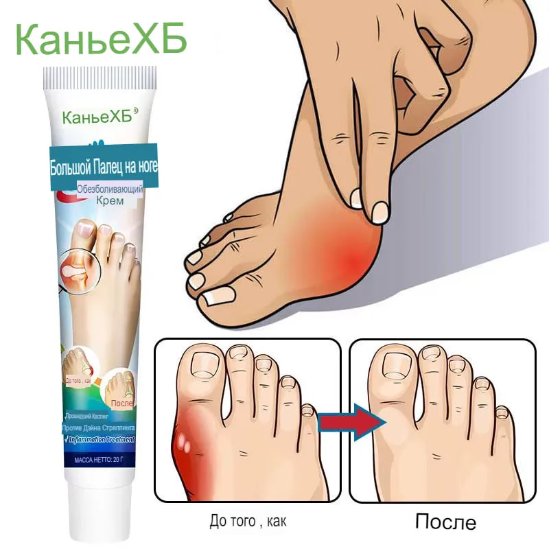 Крем для лечения подагры и артрита от боли купить на OZON по низкой ...