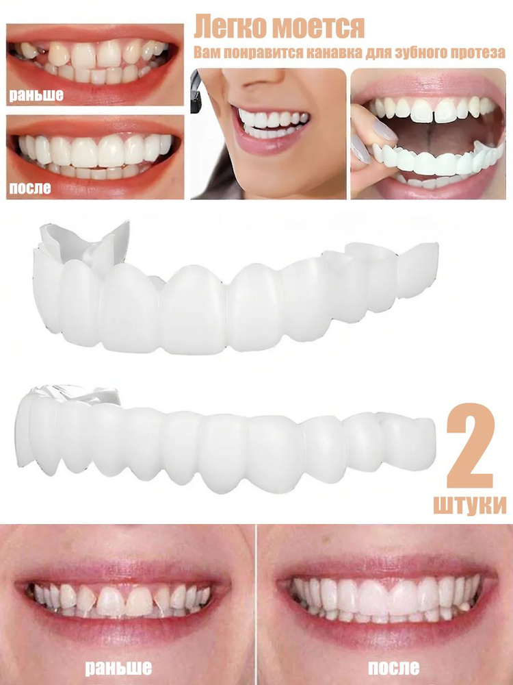 Многоразовый Защелкивающийся Протез Для Взрослых Perfect Smile #1