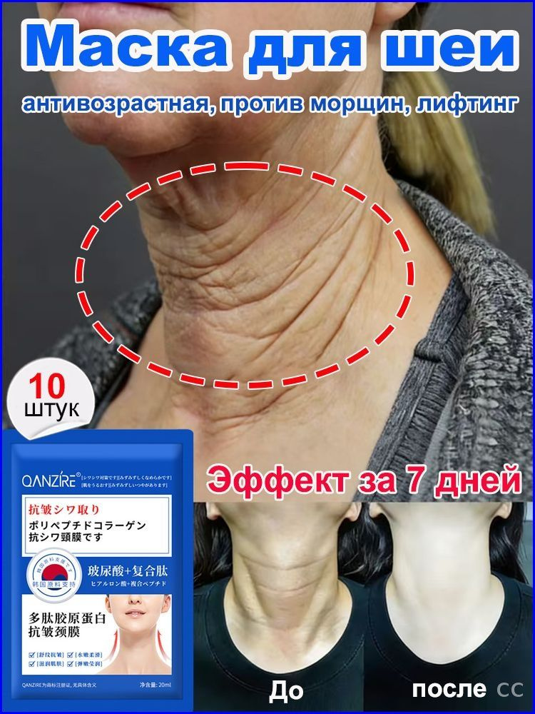 Патчи #1