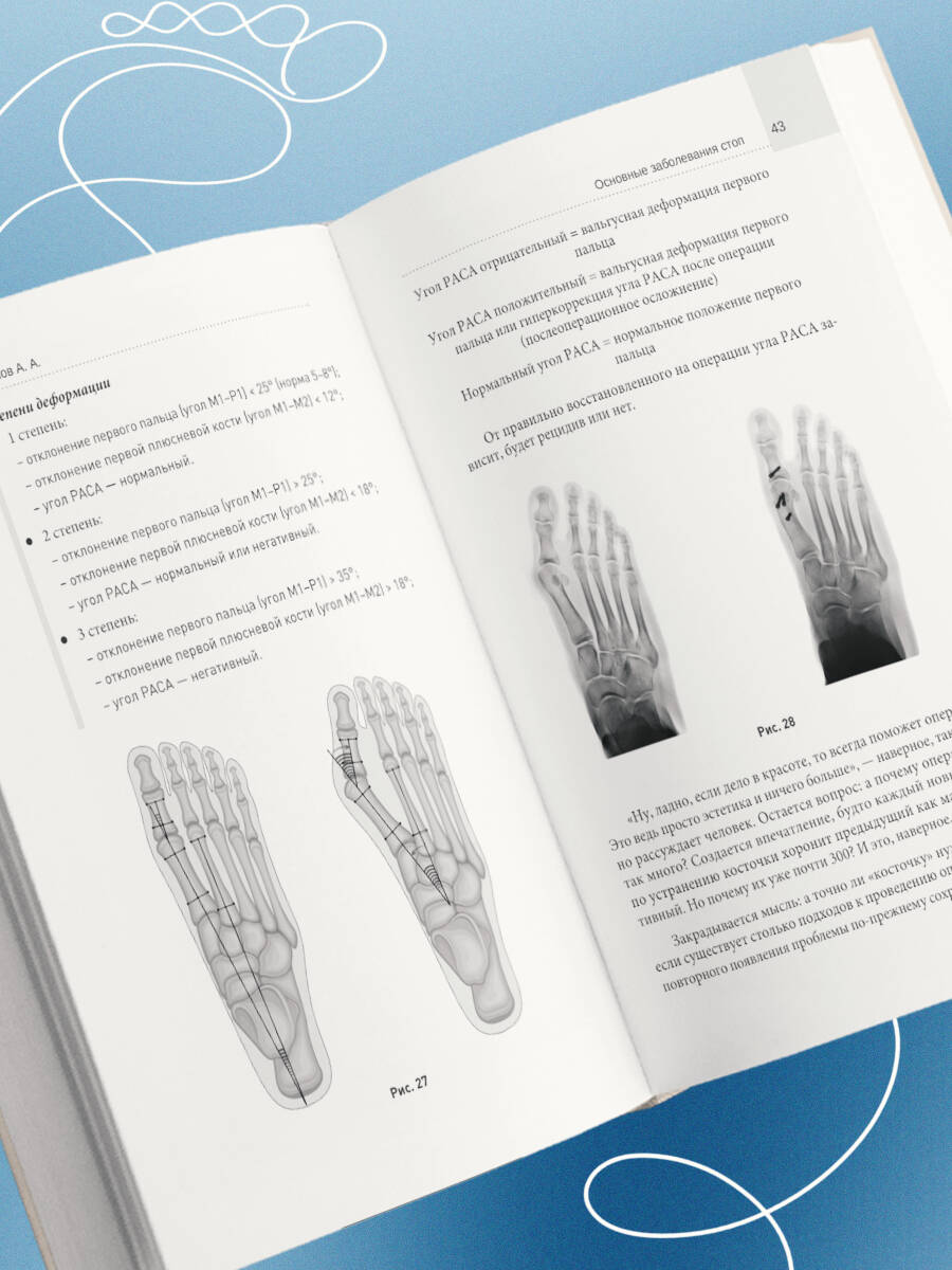 Стопы без боли. Все о плоскостопии, косточках и не только | Pain-Free Feet: A Guide to Heel Spurs, Gout, and Other Foot Problems - Ozon image 7