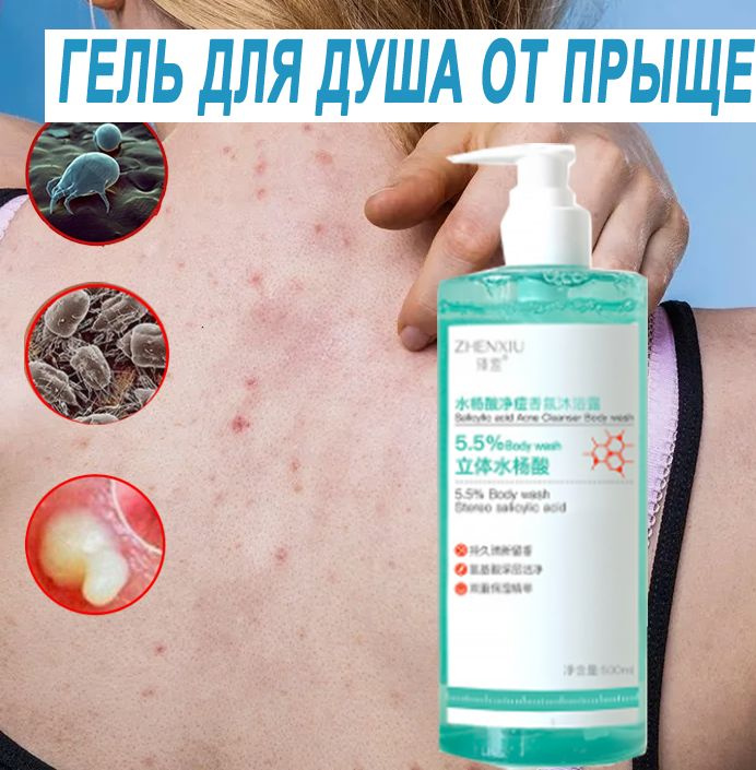 Гель для душа от прыщей, 500 мл, снимает покраснение, отек и дискомфорт, вызванные угревой сыпью, уменьшает #1