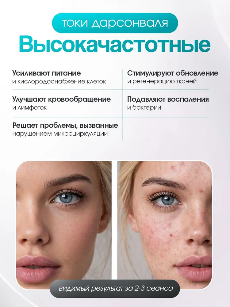 Дарсонваль аппарат для волос лица и тела 5 насадок, профессиональный микротоковый массажер для лечения прыщей, морщин и целлюлита Спарк- СТ-117, вариант, фото 6