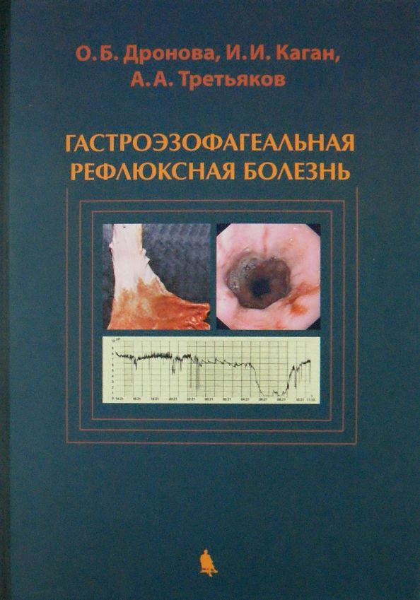 Гастроэзофагеальная рефлюксная болезнь | Дронова Ольга Борисовна, Третьяков Анатолий Андреевич  #1