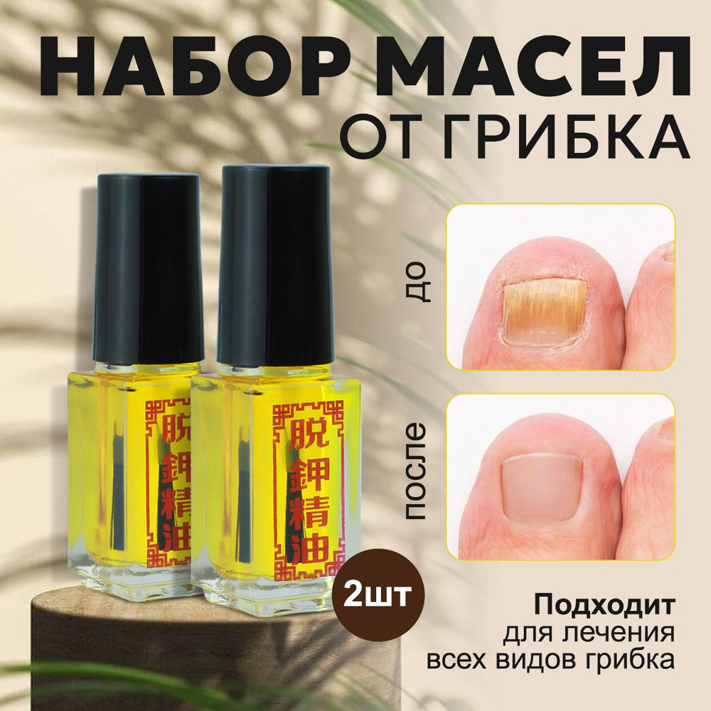 Средство от грибка ногтей на ногах, стоп онихолизис, 2 шт по 5 мл ...