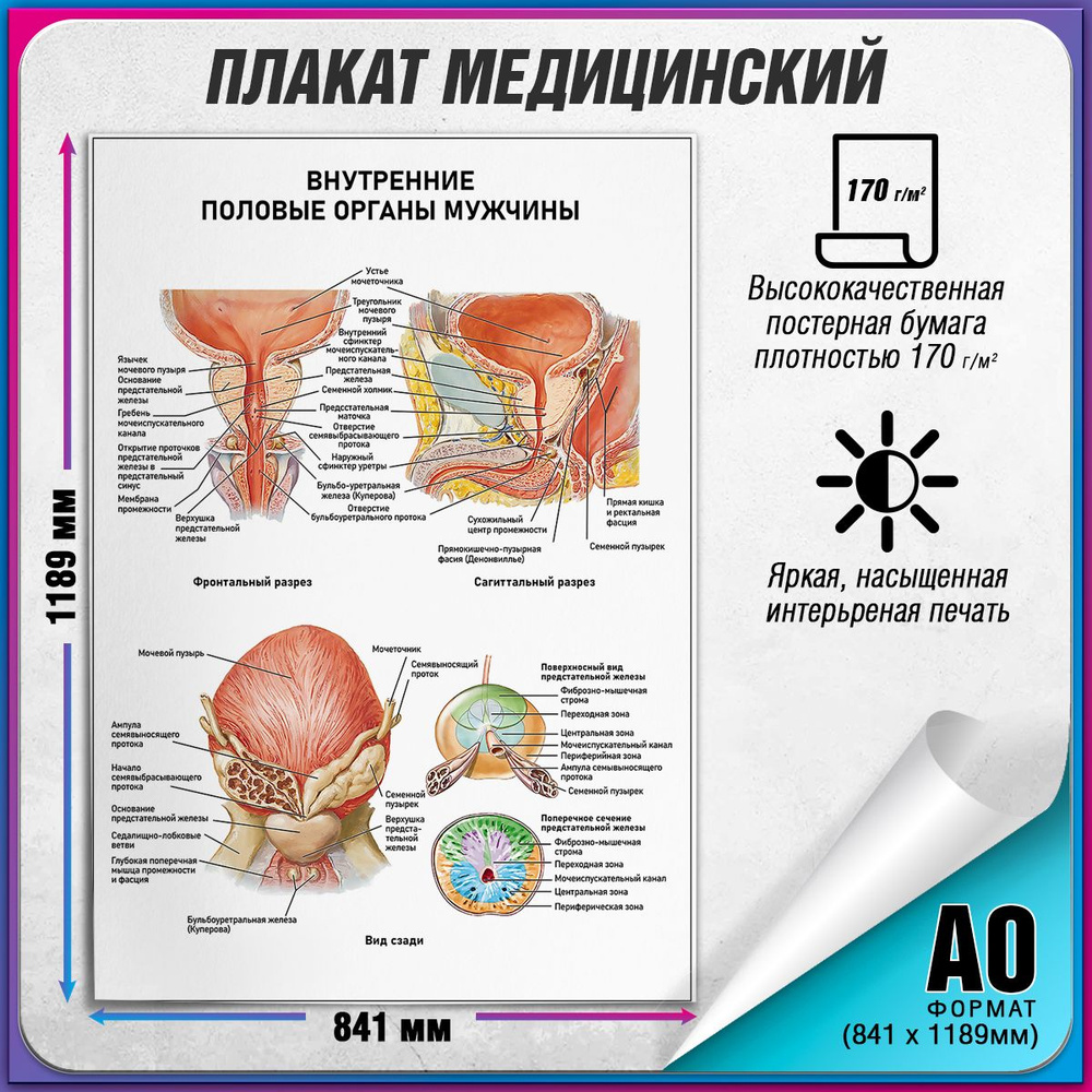 Информационный медицинский плакат "Внутренние половые органы у мужчины" / А-0 (84x119 см.)  #1