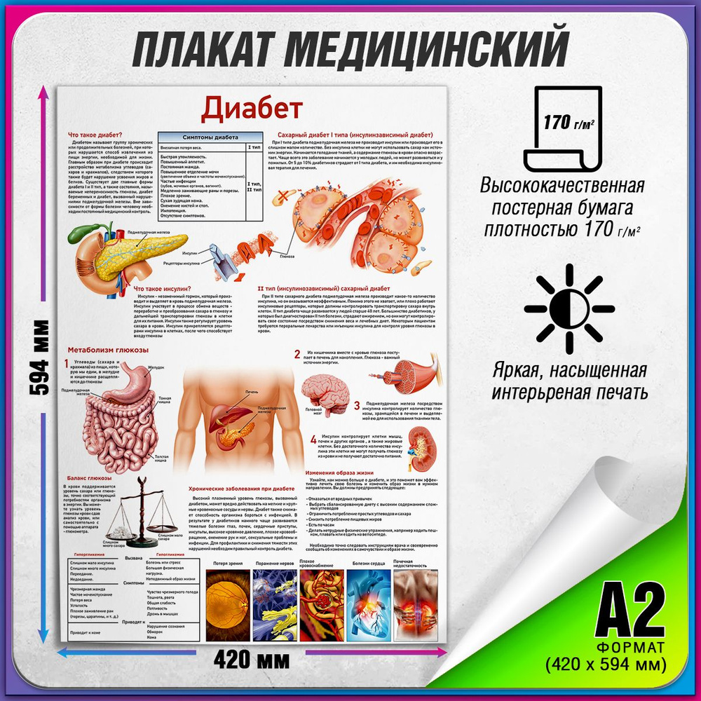 Информационный медицинский плакат "Диабет" / А-2 (60x42 см.) #1