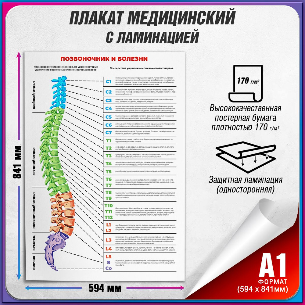 Информационный медицинский плакат "Позвоночник и болезни" / ламинированный / А-1 (60x84 см.)  #1