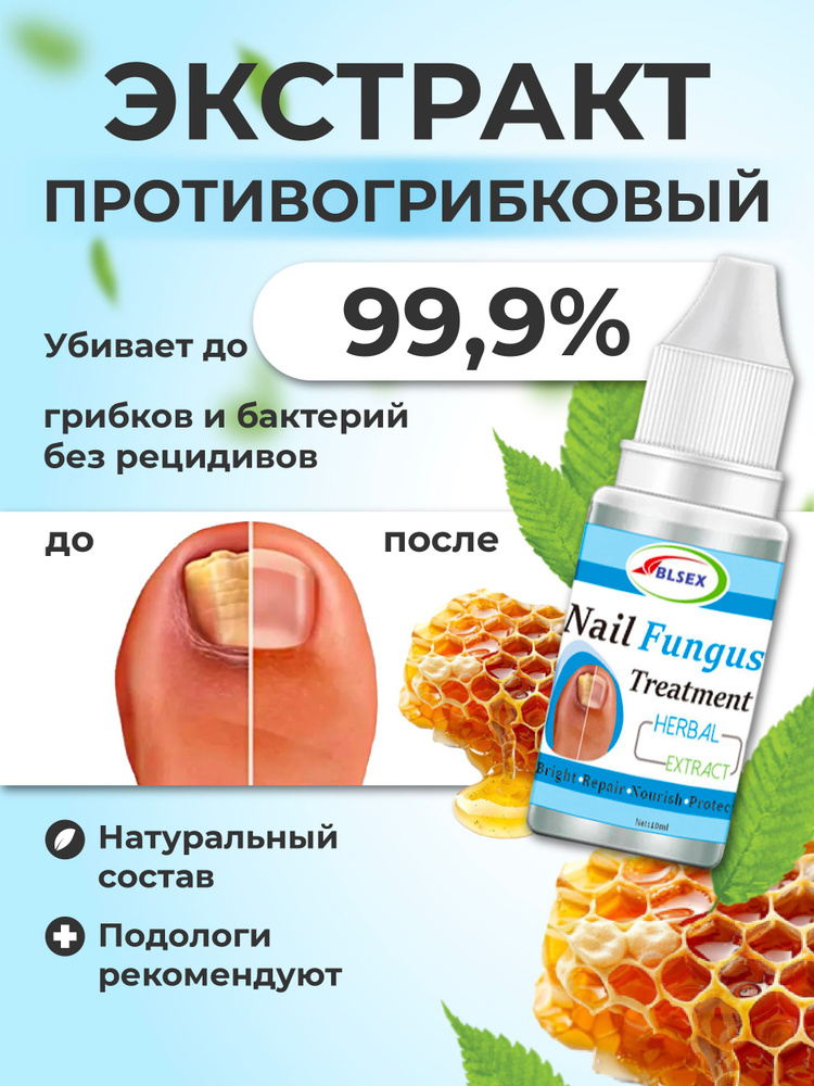 Масло для ногтей от грибка, средство для лечения грибка Fungus, 10 мл ...