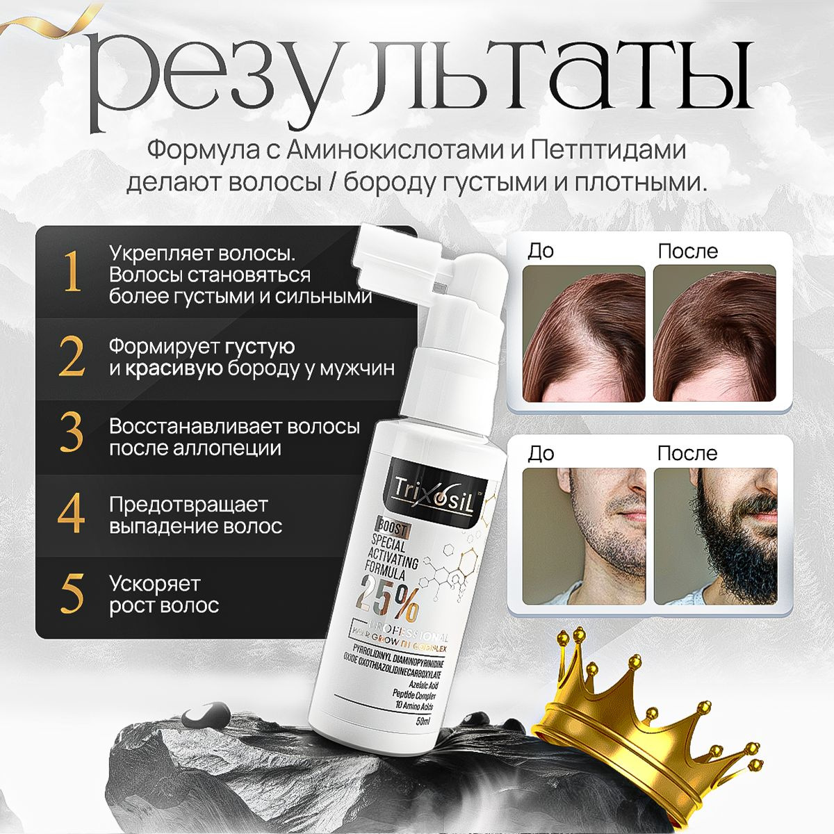 Trixosil 25% Лосьон для роста волос и бороды / Усиленная сыворотка от выпадения волос