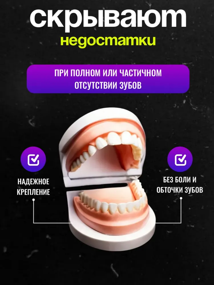 Виниры для зубов накладные верхние и нижние 2 шт. / Пломба временная, 2 шт, фото 4