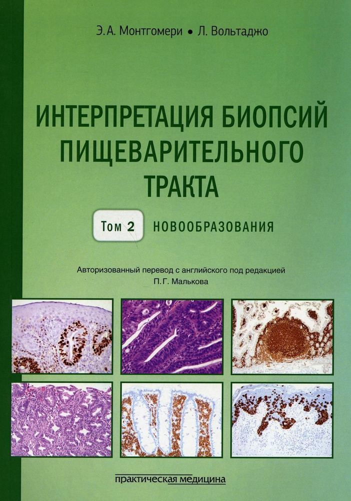 Интерпретация биопсий пищеварительного тракта. Т. 2: Новообразования | Монтгомери Э. А., Монтгомери Элисабет #1