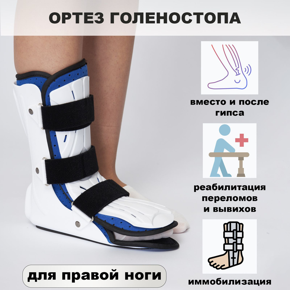 Переломы ноги: симптомы и лечение, операции при переломе ног | Госпитальный центр Семейный доктор
