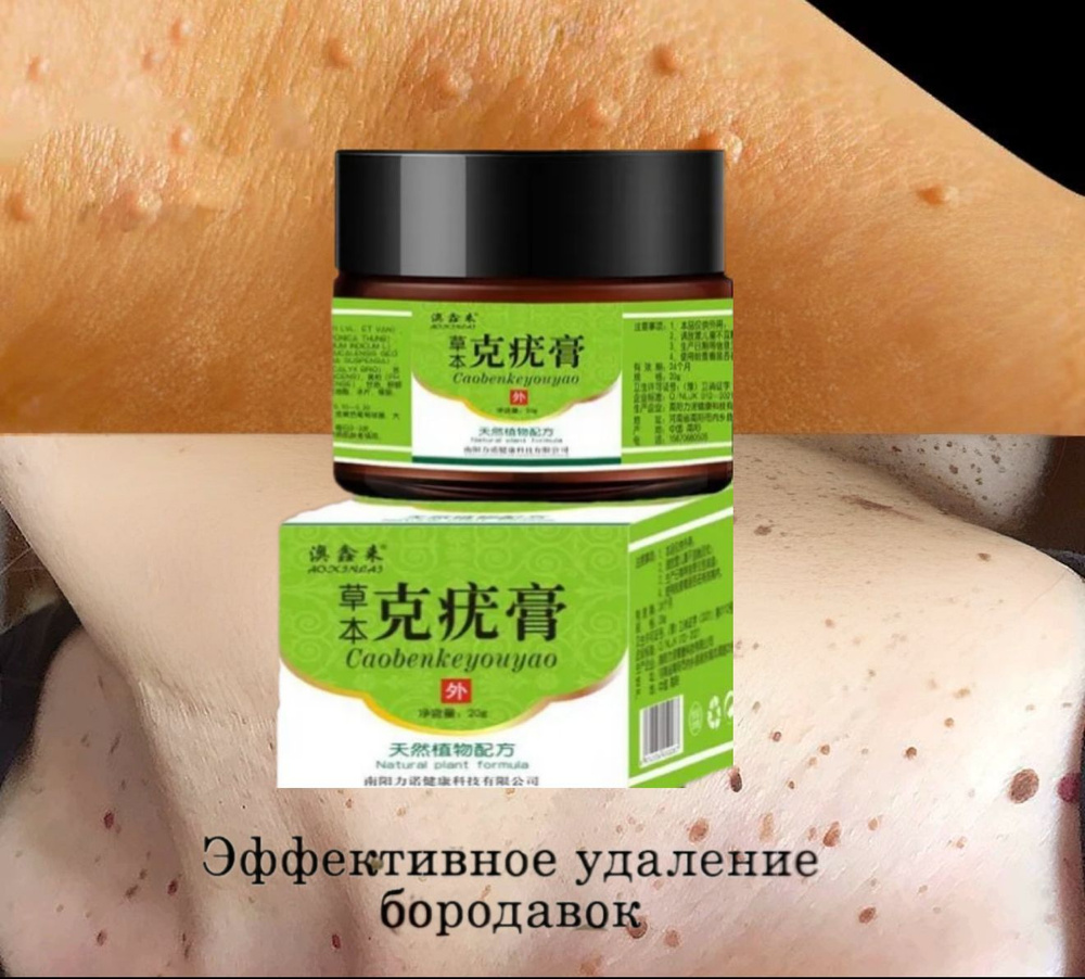 Крем от бородавок, для удаления бородавок папиллом, сухих мозолей на ...