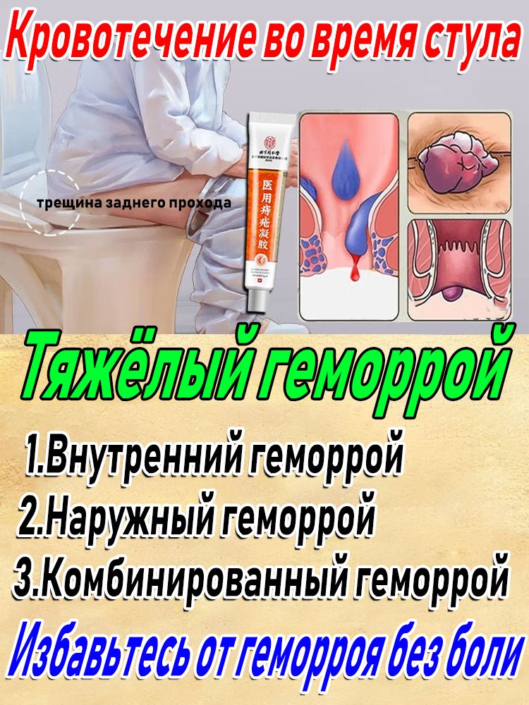 Можно Вылечить Геморрой Анальным Сексом Можно Вылечить Геморрой Анальным Сексом