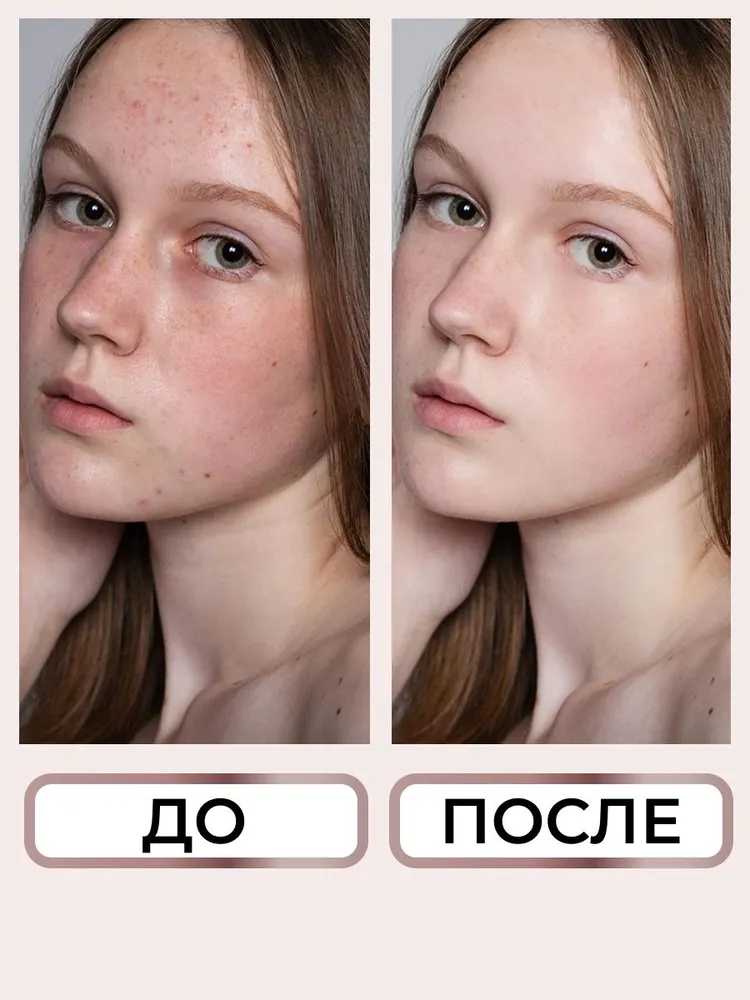 Сыворотка для лица с ниацинамидом 20% ZENZE Niacinamide Complex себорегулирующая для жирной и проблемной кожи, 30 мл, 30 мл, фото 4