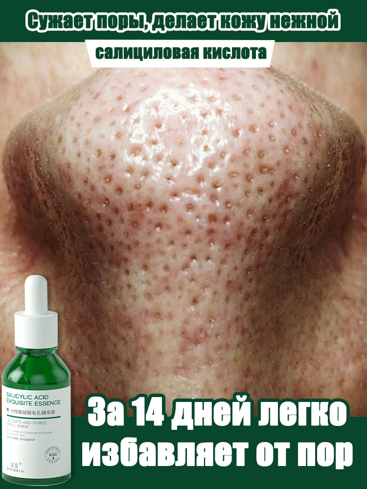 Сыворотка с салициловой кислотой 30 мл против акне, для сужения пор Восстановление водного баланса #1