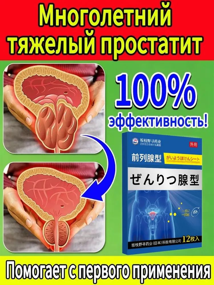 Патчи #1