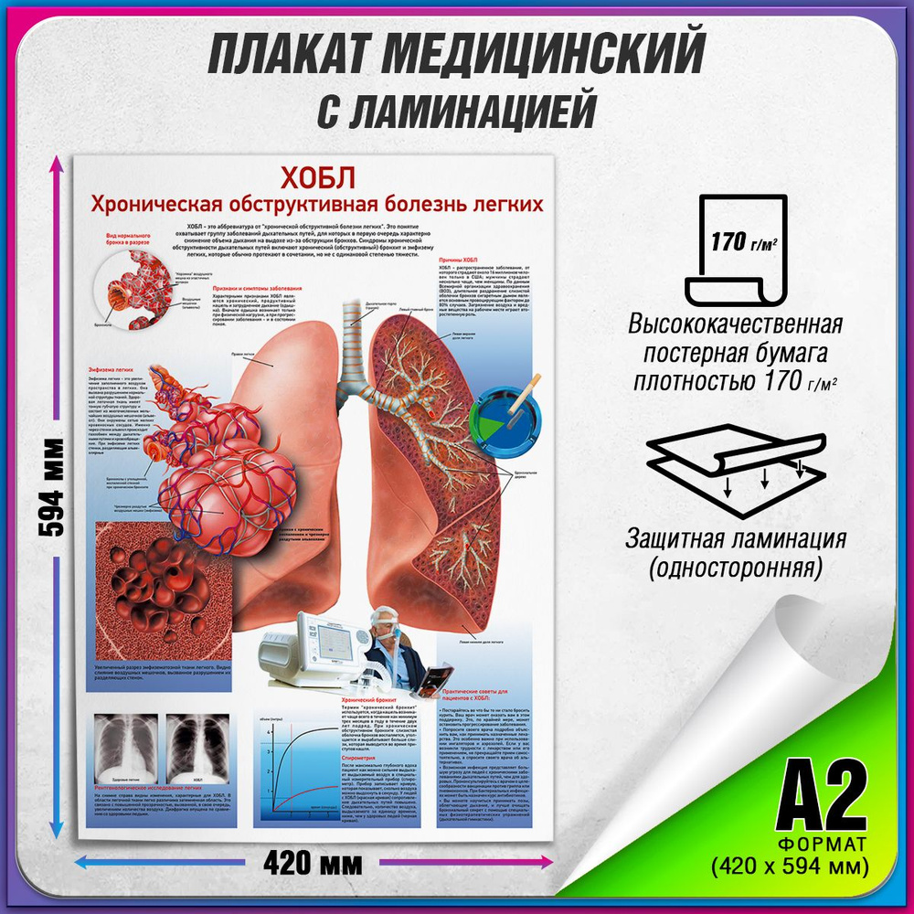 Информационный медицинский плакат "Хобл: Хроническая обструктивная болезнь легких" / ламинированный / #1