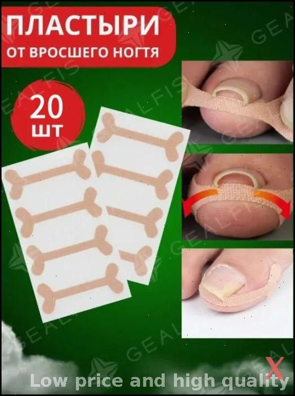 Патчи #1