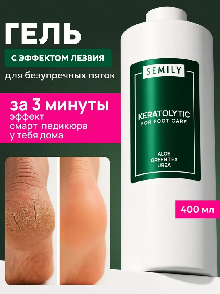 SEMILY Кератолитик для пяток с мочевиной от трещин и мозолей, жидкое лезвие для педикюра, средство от #1