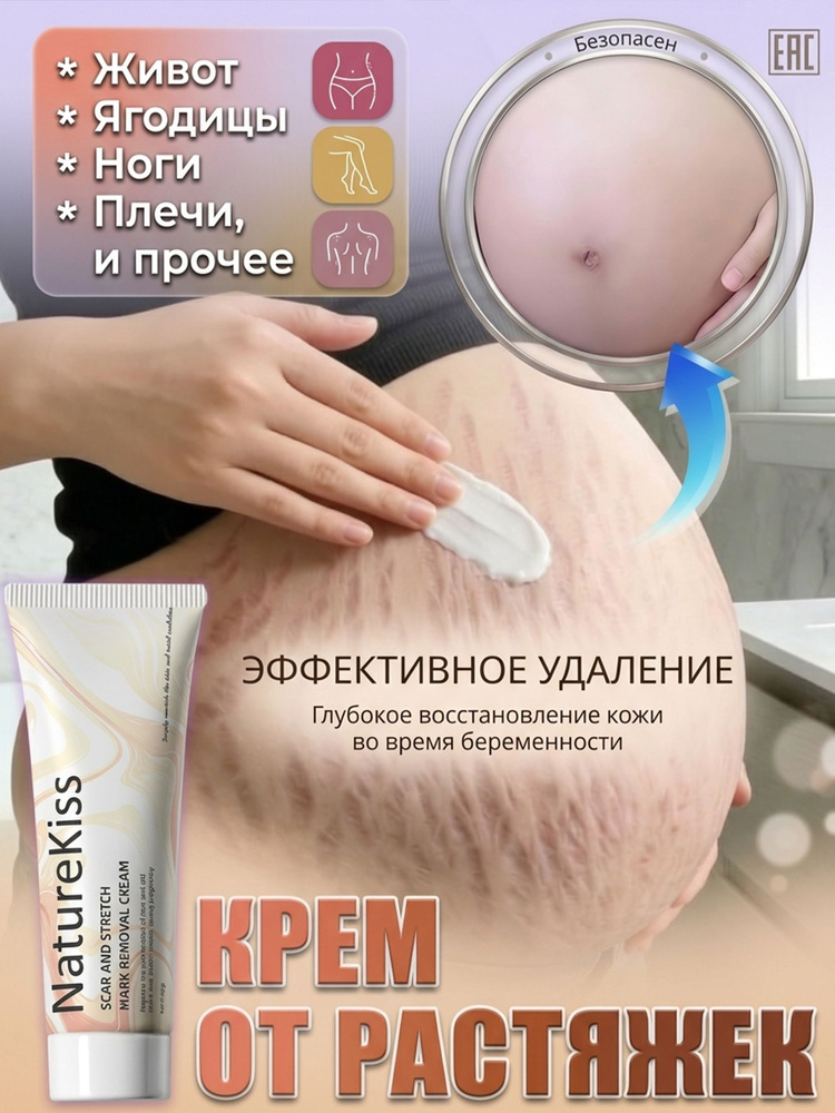 NatureKiss Крем от растяжек безопасно, для беременных, подростков и при похудении, 60 г #1