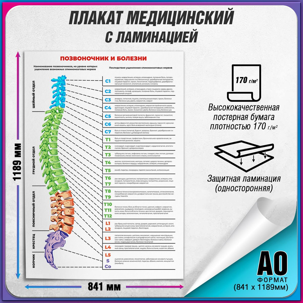 Информационный медицинский плакат "Позвоночник и болезни" / ламинированный / А-0 (84x119 см.)  #1