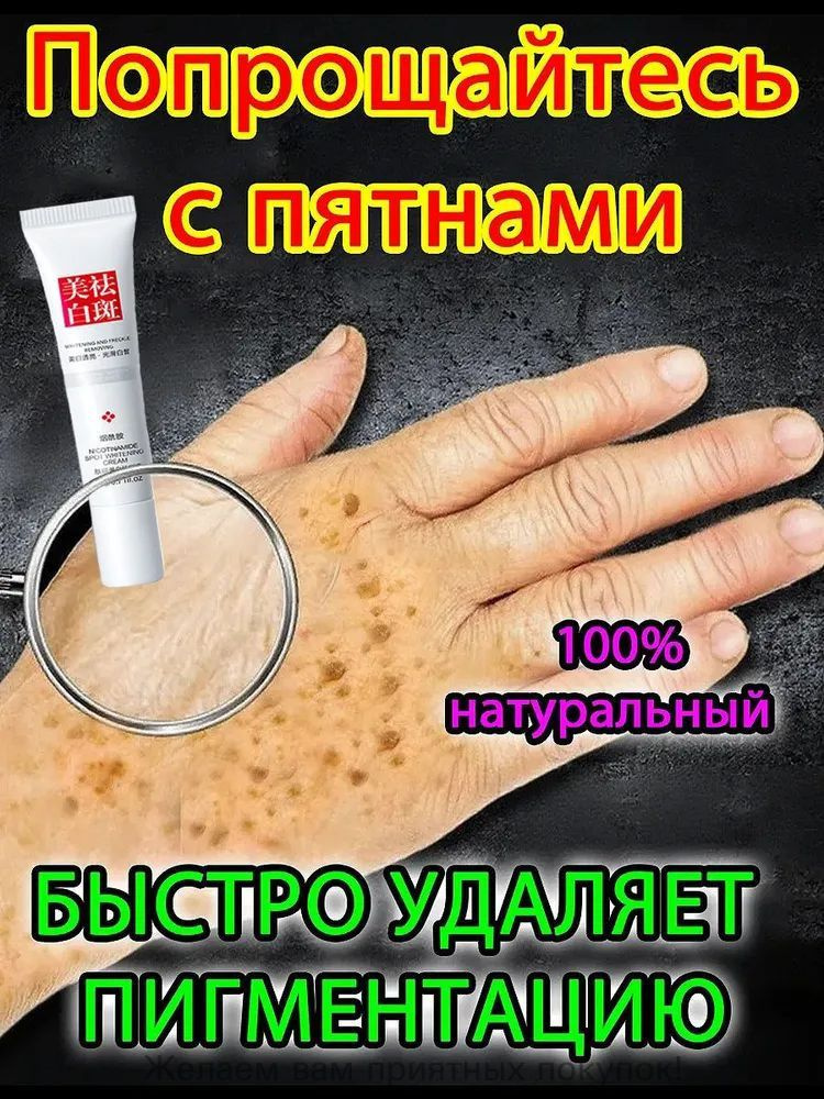 Отбеливающий крем от веснушек и солнечных пятен, подходит для удаления и исчезновения желтых пятен и #1