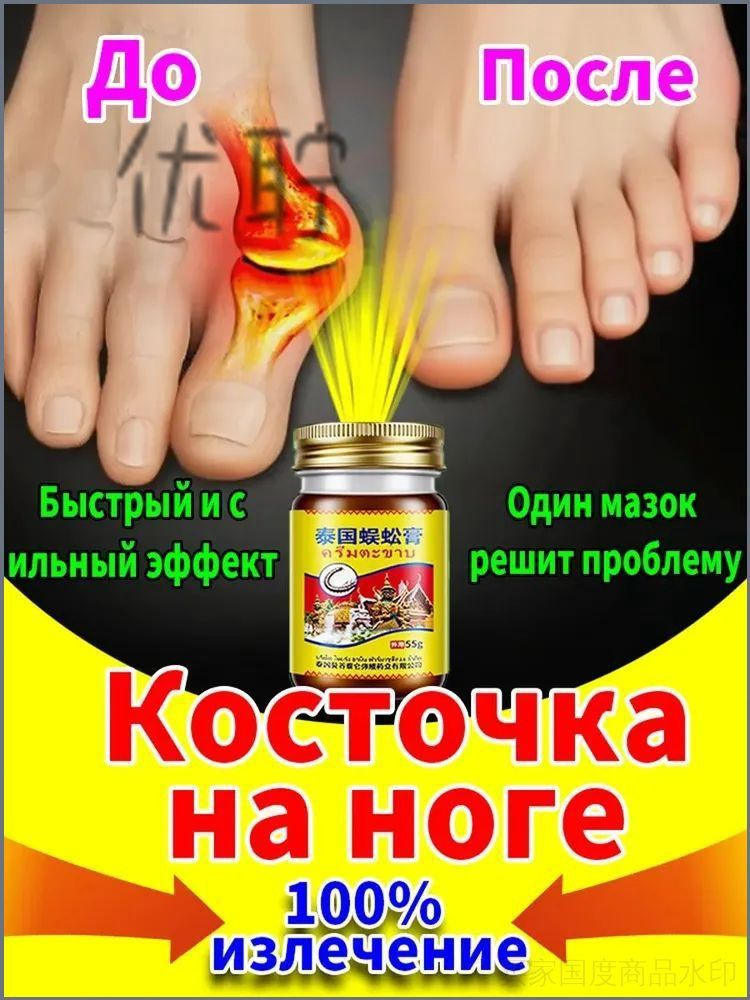 Мазь при вальгусной деформации косточки обезболивающая 55 г #1