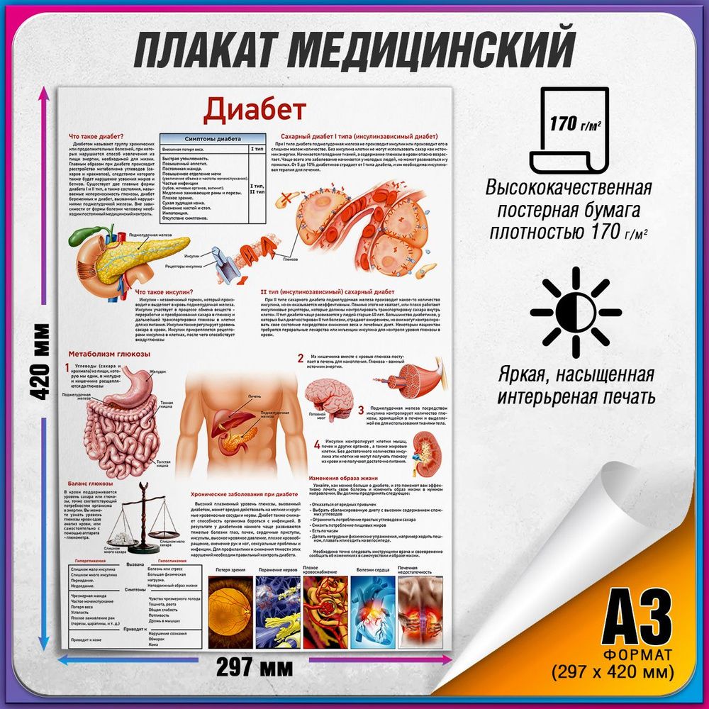 Информационный медицинский плакат "Диабет" / А-3 (30x42 см.) #1