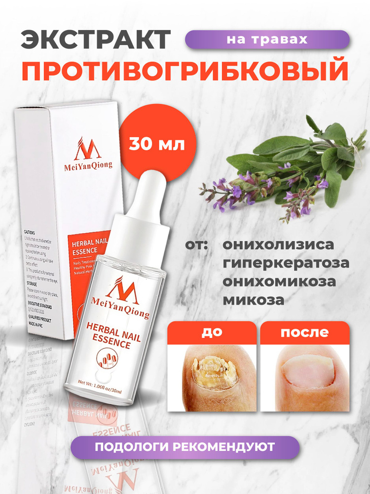 Масло для ногтей купить на OZON по низкой цене (2081686564)