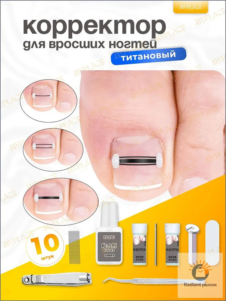 Набор инструментов , комплект корректоров для лечения вросших ногтей на ногах nn #1