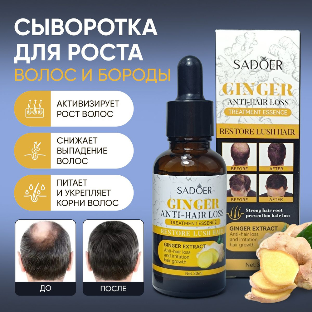 Сыворотка для роста волос, против выпадения и облысения Sadoer Ginger  инновационная формула - купить с доставкой по выгодным ценам в  интернет-магазине OZON (1540708251)