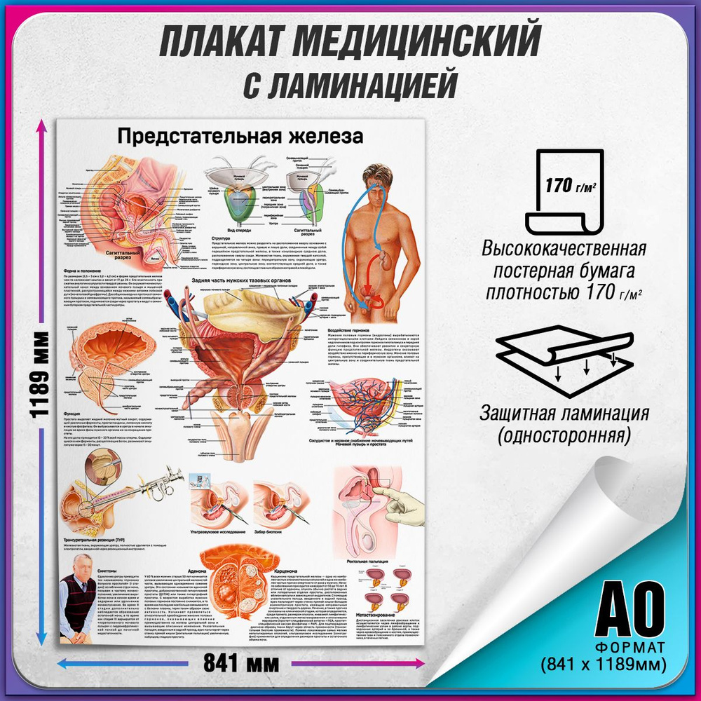 Информационный медицинский плакат "Предстательная железа" / ламинированный / А-0 (84x119 см.)  #1