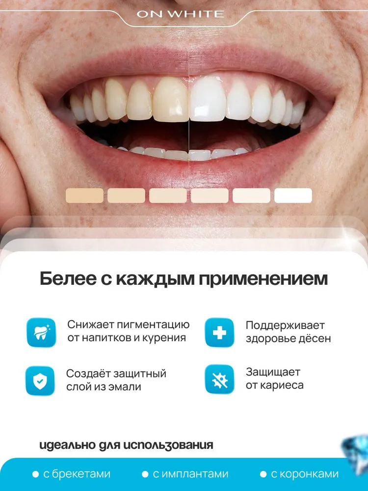 ON WHITE/ Отбеливающая жидкость для ирригатора 2 в 1, ополаскиватель для рта, уход за брекетами, свежее дыхание, белый, фото 2