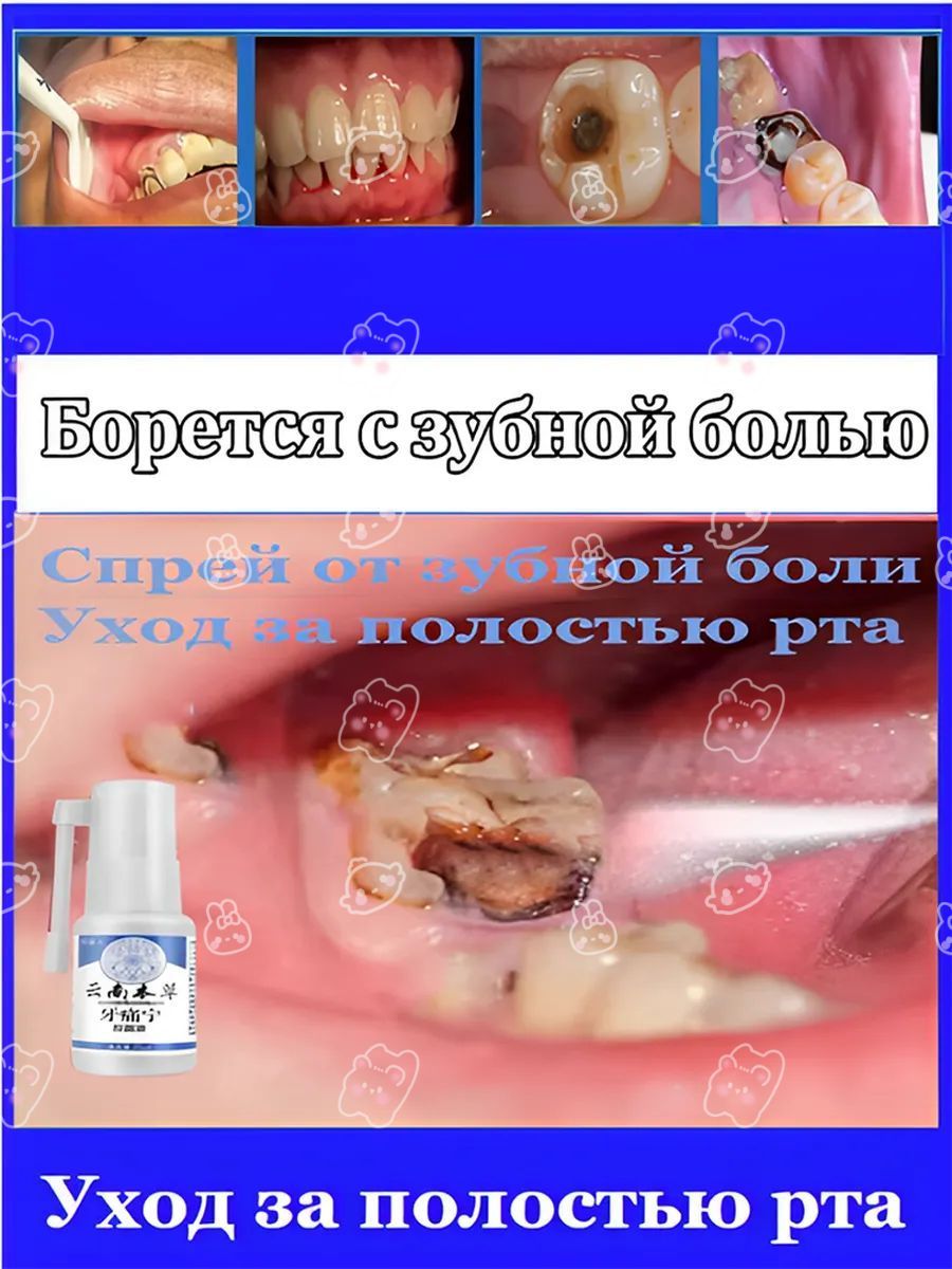 Спрейотзубнойболи,лечитзубнуюболь,быстроснимаетболь